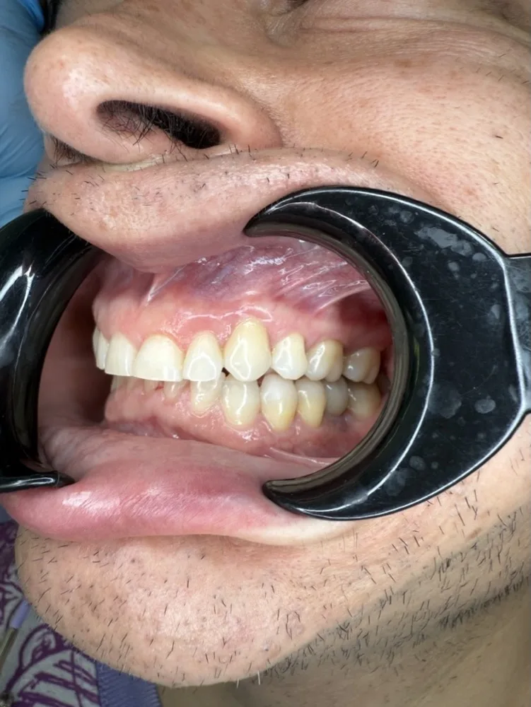 Ortodoncia, implantes y rehabilitación integral — Planificación 3D