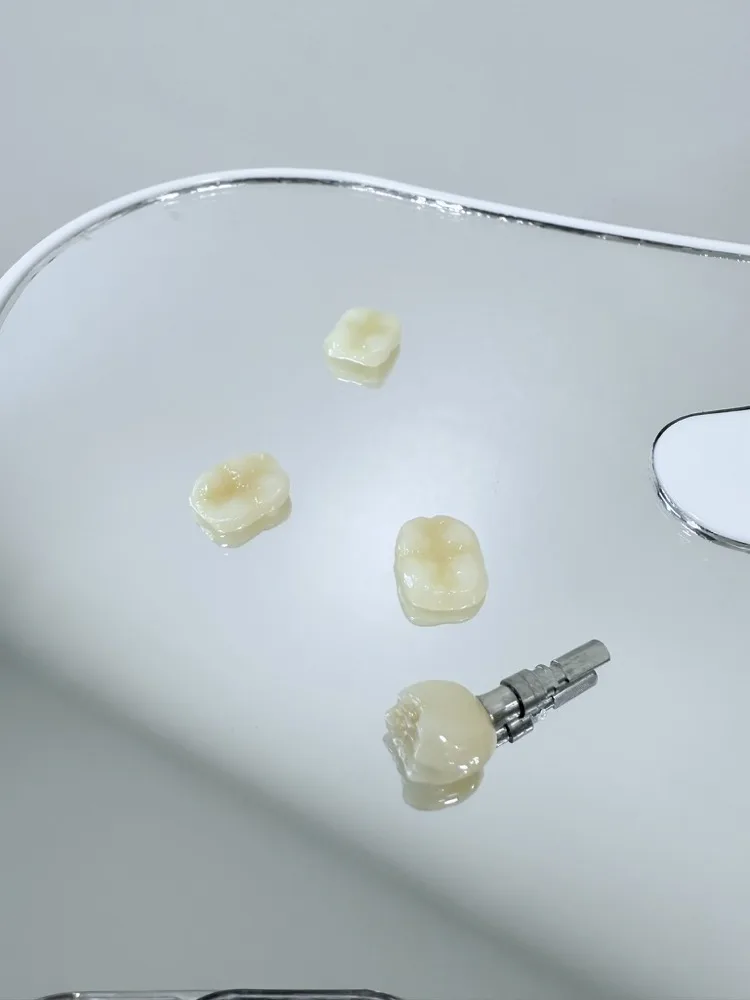 Ortodoncia, implantes y rehabilitación integral — Componentes protésicos
